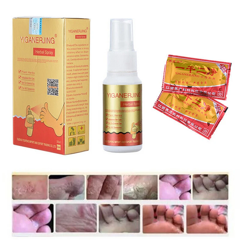30ml/bottle Natural Foot Spray Eczema Psoriasis Rosacea Pruritus Skin Chinese Herbal Feet Spray
30ml/bottle Natural Foot Spray Eczema Psoriasis Rosacea Pruritus Skin Chinese Herbal Feet Spray
