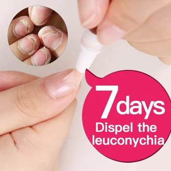 Nutrition Repair Damage Nail Treatments Pencil Anti Fungal Agnail Liquid Finger Toe Cuticle Revitalizer Feet Care Serum TSLM1
Nutrition Repair Damage Nail Treatments Pencil Anti Fungal Agnail Liquid Finger Toe Cuticle Revitalizer Feet Care Serum TSLM1