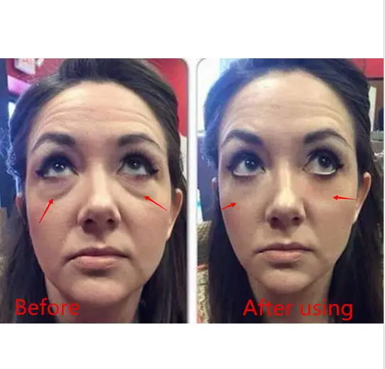 25 Sachets Jeunesse Instantly Ageless Anti-Aging Anti Wrinkle Eye Cream Fast Effective EyeBag Remove Argireline Face Lift 70
25 Sachets Jeunesse Instantly Ageless Anti-Aging Anti Wrinkle Eye Cream Fast Effective EyeBag Remove Argireline Face Lift 70