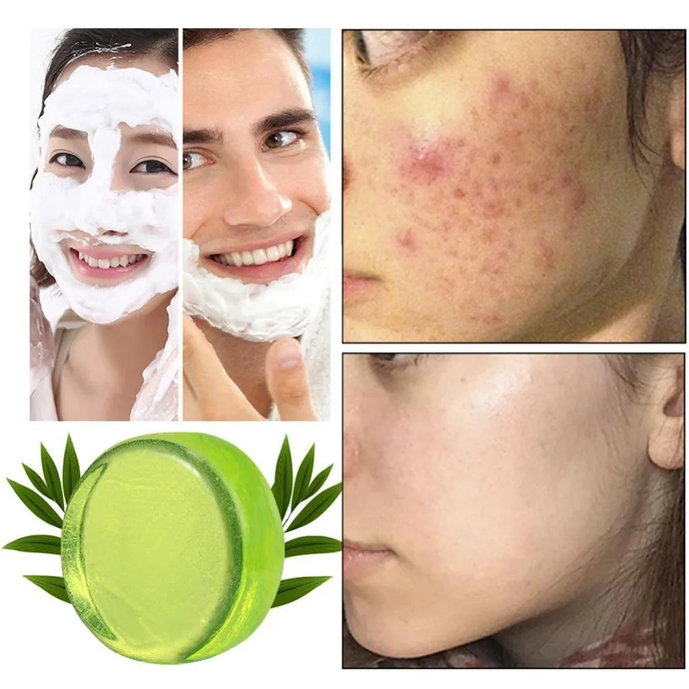 Handmade Soap Tea Tree Essential Oil Acne Soap Soothing Oil Control Cleaning Soap Moisturizing Blackhead Remover Wholesale Price
Handmade Soap Tea Tree Essential Oil Acne Soap Soothing Oil Control Cleaning Soap Moisturizing Blackhead Remover Wholesale Price