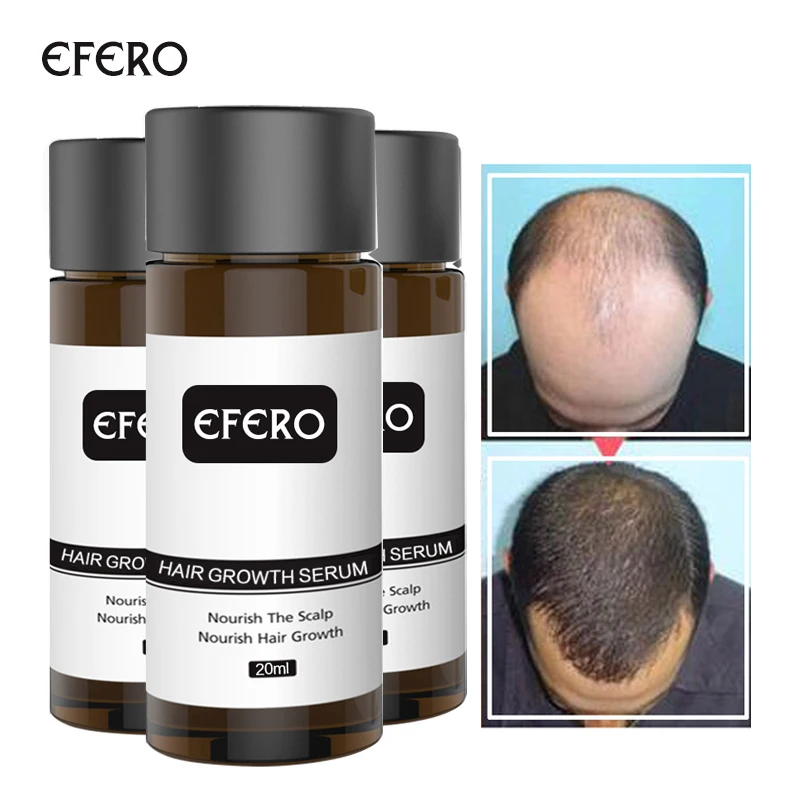 EFERO 2PCS Fast Powerful Hair Growth Essence Oil Hair Loss Products Essential Treatment for Women Men Hair Care Products 20ml
EFERO 2PCS Fast Powerful Hair Growth Essence Oil Hair Loss Products Essential Treatment for Women Men Hair Care Products 20ml