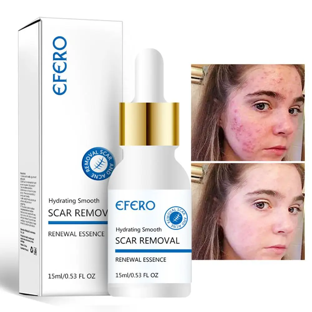 Anti-Wrinkle Moisturizing Acne Fine Pore Rejuvenation Essence Solution Repair Lifting Firming Skin Face Care
Anti-Wrinkle Moisturizing Acne Fine Pore Rejuvenation Essence Solution Repair Lifting Firming Skin Face Care