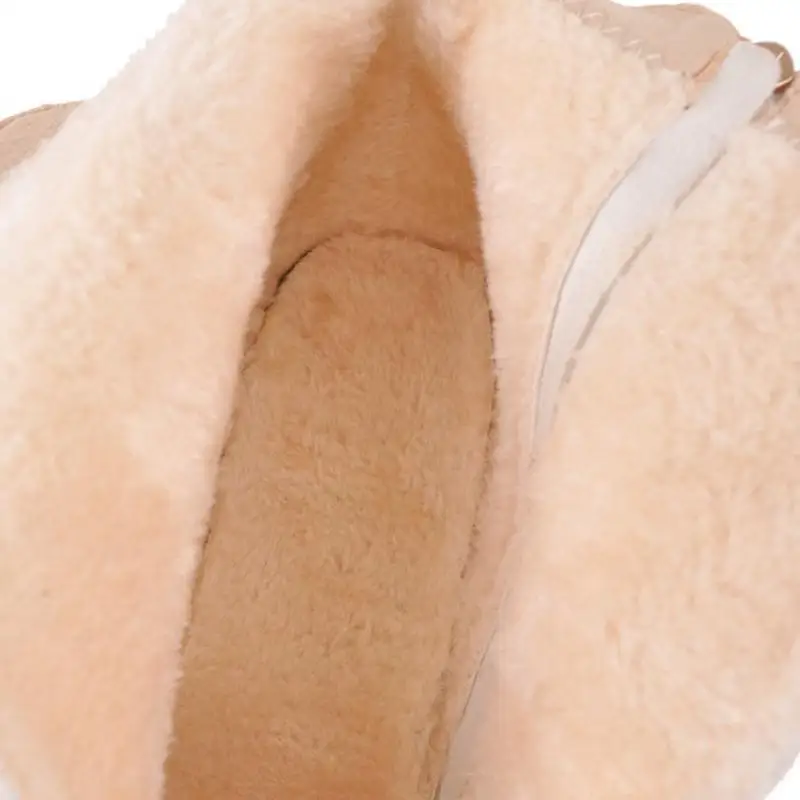 181