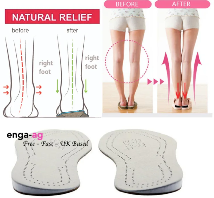 orthotics for pronation and flat feet