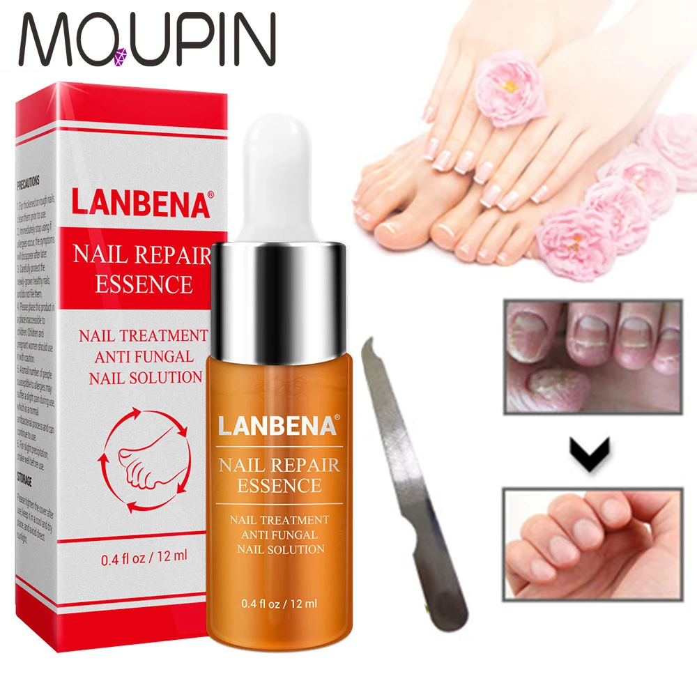 High Quality Nail Protector Repair Essence Nail Fungus Treatment Herb Nails Repair Cream Nail Care Tools With a File
High Quality Nail Protector Repair Essence Nail Fungus Treatment Herb Nails Repair Cream Nail Care Tools With a File