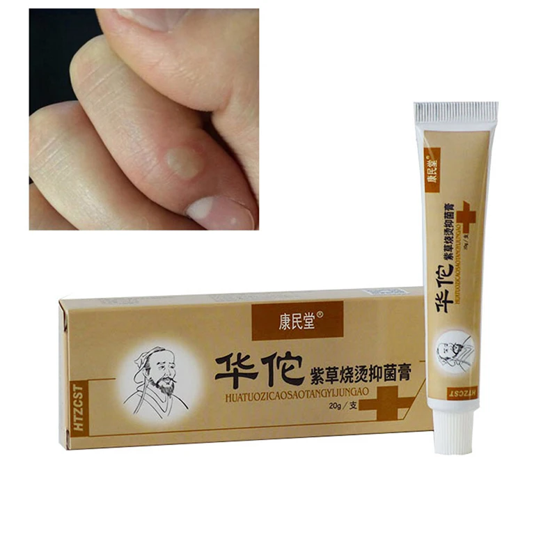 Anti-infection Cream Antibacterial Burn Wound Care Ointment Burns Better Faster Inhibit Scar Tyrosinase Inhibition Formation
Anti-infection Cream Antibacterial Burn Wound Care Ointment Burns Better Faster Inhibit Scar Tyrosinase Inhibition Formation