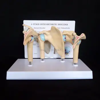 Shoulder Osteoarthritic (OA) 4-Stage Anatomical Model Human Brain with Arteries skeleton dental brain anatomia skull
Shoulder Osteoarthritic (OA) 4-Stage Anatomical Model Human Brain with Arteries skeleton dental brain anatomia skull