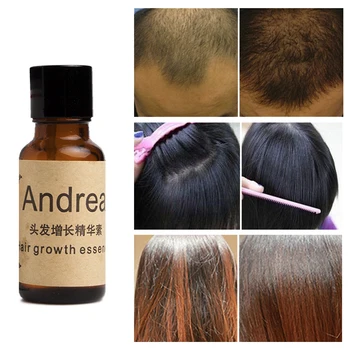 LANBENA Andrea Hair Growth Essence Hair Loss Liquid 20ml dense hair 1 bottle