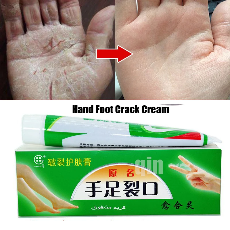 2Pcs/lot Chinese Cosmetics Hand Foot Crack Cream Heel Chapped Peeling Repair Anti Dry Crack Ointment Exfoliating Foot Cream
2Pcs/lot Chinese Cosmetics Hand Foot Crack Cream Heel Chapped Peeling Repair Anti Dry Crack Ointment Exfoliating Foot Cream