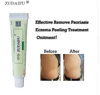 Dedicated links Sulfur Antibacterial ZUDAIFU Handmade Chinese Herbal Natural Restrain
Dedicated links Sulfur Antibacterial ZUDAIFU Handmade Chinese Herbal Natural Restrain