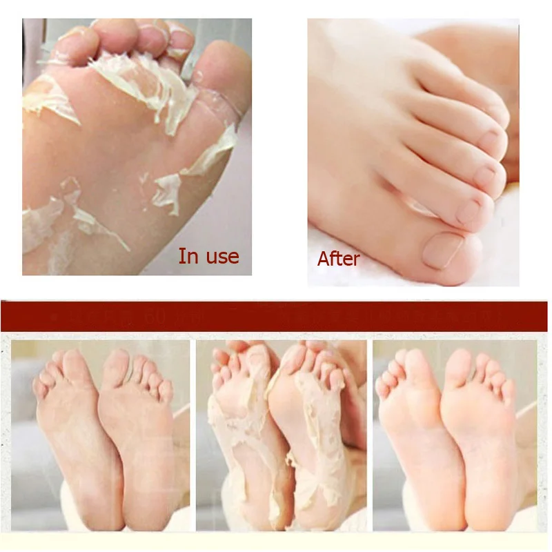6Pack Foot Mask Exfoliating Feet Cuticle Remover Whitening Pedicure Socks Peeling Dead Baby Feet Skin Smooth Foot Exfoliante Pie
6Pack Foot Mask Exfoliating Feet Cuticle Remover Whitening Pedicure Socks Peeling Dead Baby Feet Skin Smooth Foot Exfoliante Pie