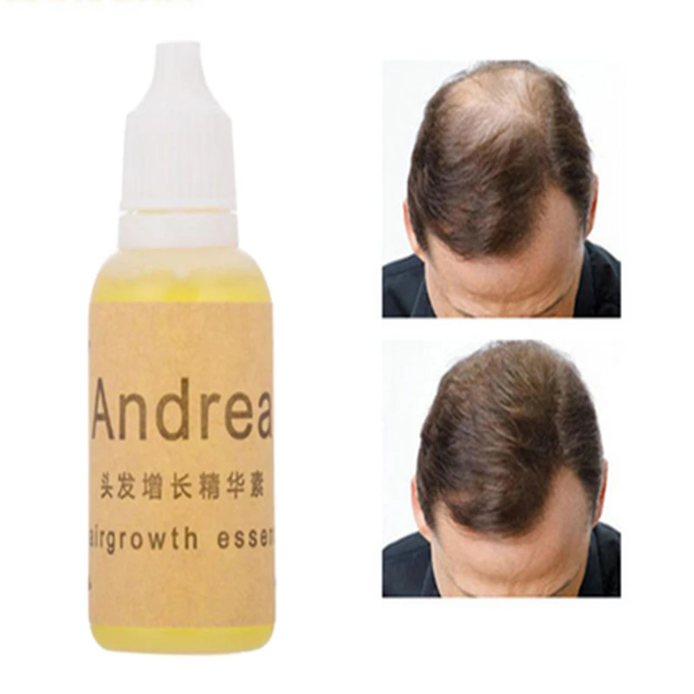 Hair Growth Oil Essence Fast Regrowth Hair Growth Thickener Liquid Natural Plant Formula Anti Hair Loss Herbal Keratin Product
Hair Growth Oil Essence Fast Regrowth Hair Growth Thickener Liquid Natural Plant Formula Anti Hair Loss Herbal Keratin Product