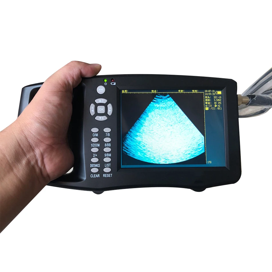 Portable Pig Ultrasound Veterinary Ultrasound Pregnancy Test Instrument Color B Ultrasonic Detector
Portable Pig Ultrasound Veterinary Ultrasound Pregnancy Test Instrument Color B Ultrasonic Detector