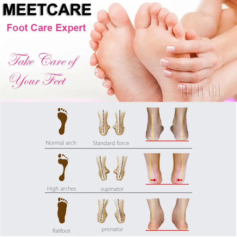 Foot-Care-Expert-Flat-Foot