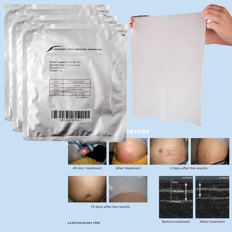 

Fashion New Arrival 10pcs Antifreeze Membrane 27*30cm 34*42cm Antifreezing Anti-freezing Pad For Cryo Therapy