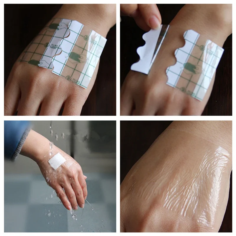 100 Pcs/set Medical Transparent Tape PU film Adhesive Plaster Waterproof Anti-allergic Medicinal Wound Dressing Fixation Tape
100 Pcs/set Medical Transparent Tape PU film Adhesive Plaster Waterproof Anti-allergic Medicinal Wound Dressing Fixation Tape