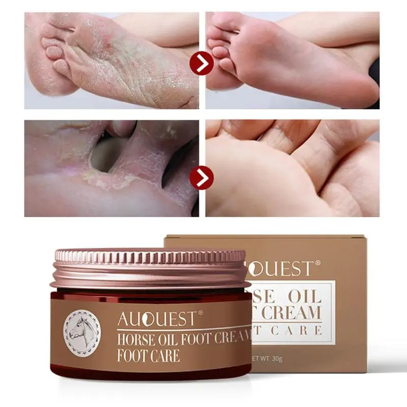 1pcs Horse Oil Cracked Heel Balm Cream For Rough Dry Cracked Chapped Feet Heel Moisturizer Care Anti-fungal Exfoliator Repair
1pcs Horse Oil Cracked Heel Balm Cream For Rough Dry Cracked Chapped Feet Heel Moisturizer Care Anti-fungal Exfoliator Repair