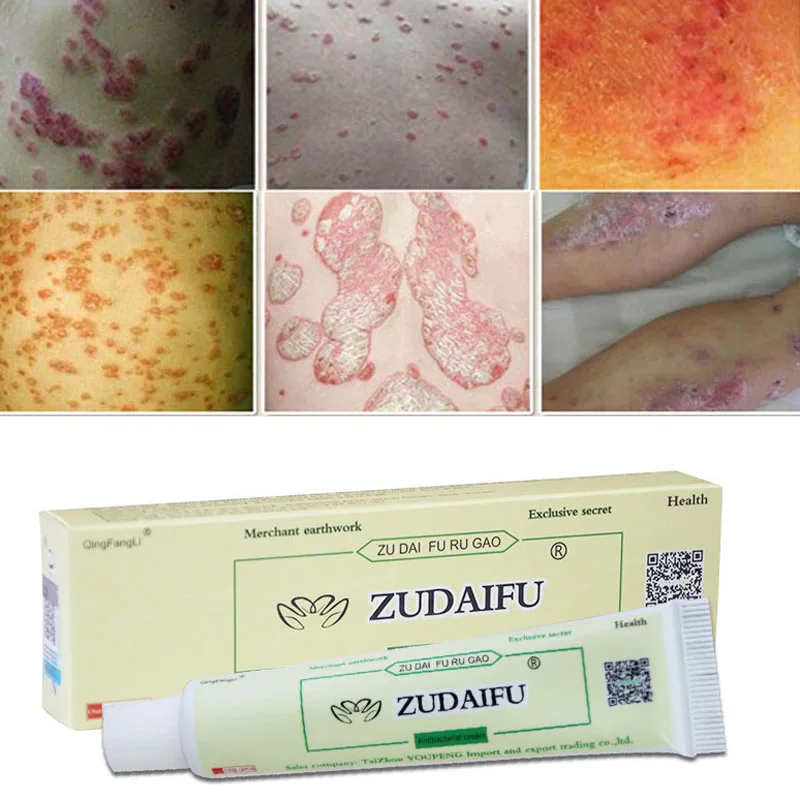 DUS Dropshipping Profesprofessional Cure Psoriasis Ointment Medicine Ingredient Security For All Kinds Of Skin Problems
DUS Dropshipping Profesprofessional Cure Psoriasis Ointment Medicine Ingredient Security For All Kinds Of Skin Problems
