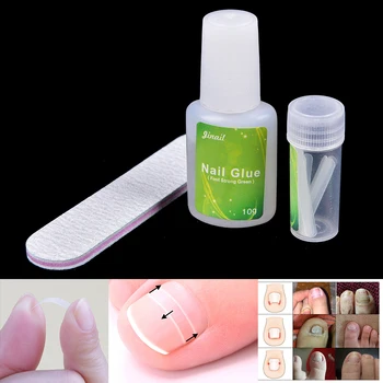 12pcs Nail Gel Toenail Ingrown Toenail Pedicure Tool Straightening Clip Curved Brace With Glue Kit For Toenails Toe Nail
12pcs Nail Gel Toenail Ingrown Toenail Pedicure Tool Straightening Clip Curved Brace With Glue Kit For Toenails Toe Nail