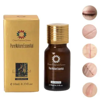Pure Remove Ance Burn Strentch Marks Scar Removal Ultra Brightening Spotless Oil Lavender Natural Essence Skin Care S1
Pure Remove Ance Burn Strentch Marks Scar Removal Ultra Brightening Spotless Oil Lavender Natural Essence Skin Care S1