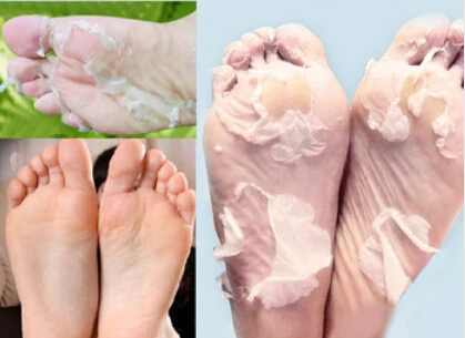 Pedicure Socks Baby Foot Peeling Renewal Foot Mask Remove Dead Skin Cuticles Heel Feet Care Exfoliating Foot Skin Care
Pedicure Socks Baby Foot Peeling Renewal Foot Mask Remove Dead Skin Cuticles Heel Feet Care Exfoliating Foot Skin Care