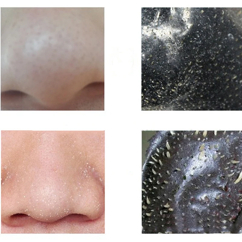 10pcs Nose Mask Deep Nose Pore Cleasing Strips Bamboo Charcoal Blackhead Remover Nose Sticker Beauty Makeup Tools
10pcs Nose Mask Deep Nose Pore Cleasing Strips Bamboo Charcoal Blackhead Remover Nose Sticker Beauty Makeup Tools