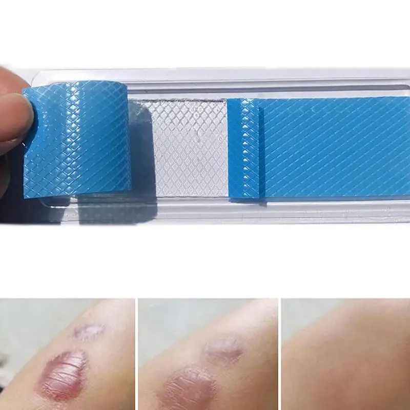 Reusable Acne Gel Scar Removal Patch Therapy Silicon Patch Silicone Remove Trauma Burn Sheet Skin Repair
Reusable Acne Gel Scar Removal Patch Therapy Silicon Patch Silicone Remove Trauma Burn Sheet Skin Repair
