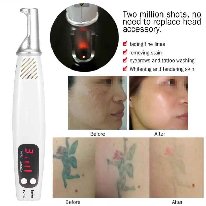 Professional Picosecond Scar Tattoo Scar Acne Removal Pen Red Light Therapy For Melanin Diluting Freckle Spot Removal Device
Professional Picosecond Scar Tattoo Scar Acne Removal Pen Red Light Therapy For Melanin Diluting Freckle Spot Removal Device