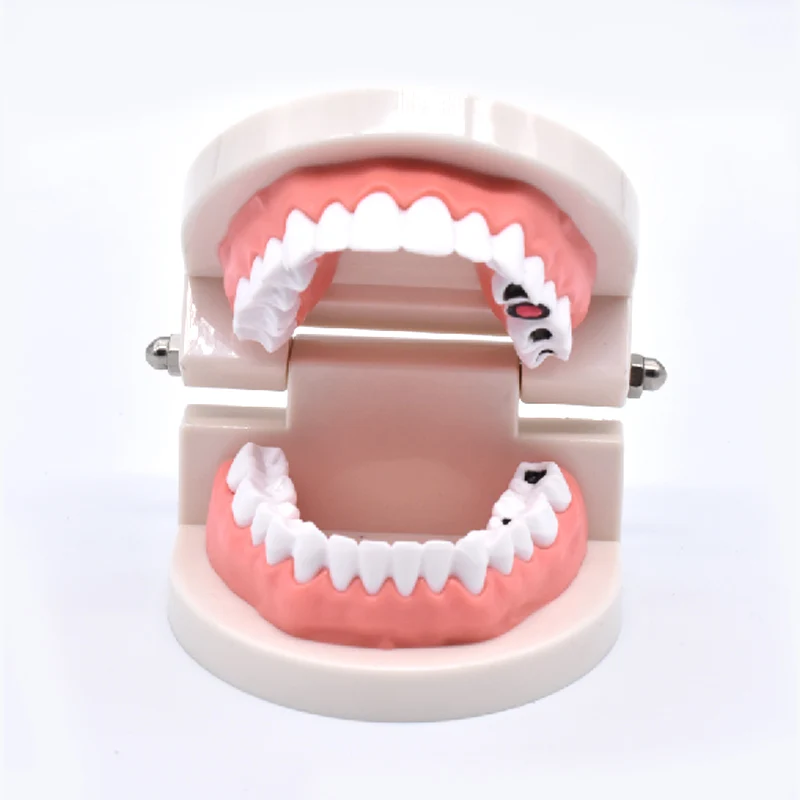 Dental Caries Model Study Teaching Teeth Model Teeth Care Education Dental Tools Dentist Material Dentistry Laboratory Equipment
Dental Caries Model Study Teaching Teeth Model Teeth Care Education Dental Tools Dentist Material Dentistry Laboratory Equipment