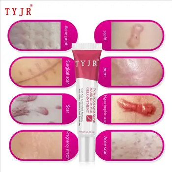 10pcs/lot TYJR Highly Effective Acne Treatment Cream Moisturizing Scar Removal Face Cream Good Skin Care Product
10pcs/lot TYJR Highly Effective Acne Treatment Cream Moisturizing Scar Removal Face Cream Good Skin Care Product