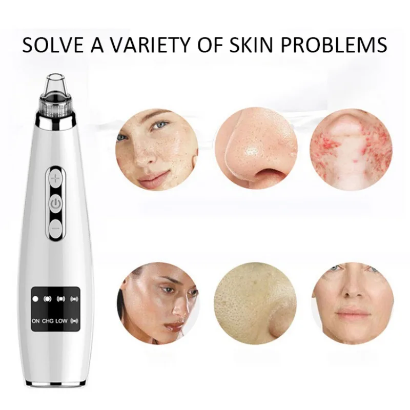 3 Minutes Electric Blackhead Needle Remover Cleaner Tool Acne Pimple Spot Extractor Beauty Facial Cleaning Tools Recommend
3 Minutes Electric Blackhead Needle Remover Cleaner Tool Acne Pimple Spot Extractor Beauty Facial Cleaning Tools Recommend