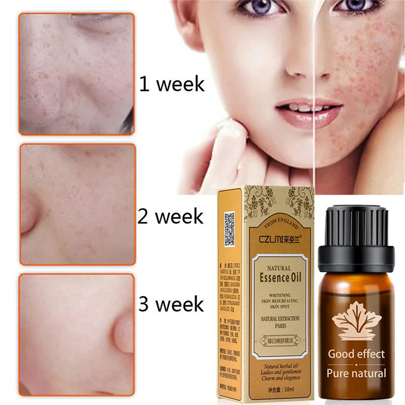 Natural Essential Oil Ultra Brightening Spotless Oil Dark Spots Removal Age Spots Hyper Pigmentation essential oil dropship Jan2
Natural Essential Oil Ultra Brightening Spotless Oil Dark Spots Removal Age Spots Hyper Pigmentation essential oil dropship Jan2