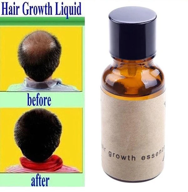 1pc Hair Growth Essence Hair Loss Liquid 20ml dense hair fast sunburst grow Restoration pilatory hair regrowth product
1pc Hair Growth Essence Hair Loss Liquid 20ml dense hair fast sunburst grow Restoration pilatory hair regrowth product