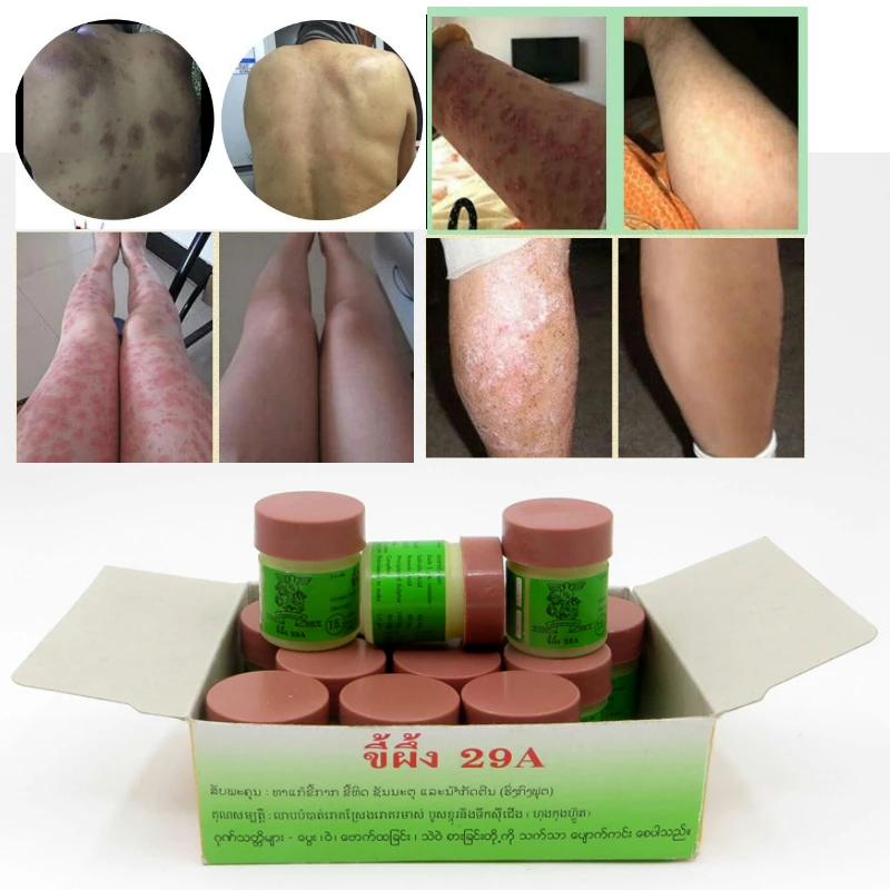 2PCS Psoriasis Eczma Cream Works Perfect For All Kinds Of Skin Problems Patch Body Massage Ointment External use only 
2PCS Psoriasis Eczma Cream Works Perfect For All Kinds Of Skin Problems Patch Body Massage Ointment External use only