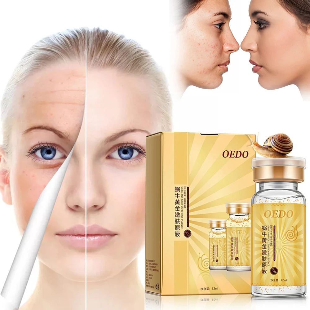OEDO Anti-Aging Hyaluronic Acid Cream Essence Snail Pure Extract Moisturizing Anti Wrinkle Removal Acne Cream TSLM2
OEDO Anti-Aging Hyaluronic Acid Cream Essence Snail Pure Extract Moisturizing Anti Wrinkle Removal Acne Cream TSLM2