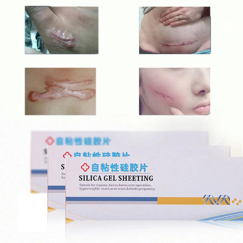 New Waterproof Cover Scar Long Lasting Personality Free Cut Display Alone New Super Invisible Tattoo and Scar Ribbon Wholesale
New Waterproof Cover Scar Long Lasting Personality Free Cut Display Alone New Super Invisible Tattoo and Scar Ribbon Wholesale