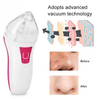 Blackhead Removal Electronic Face Clean Pore Vacuum Acne Machine Suction Facial Cleaner Extractor No Bleeding Mole Dot Removing
Blackhead Removal Electronic Face Clean Pore Vacuum Acne Machine Suction Facial Cleaner Extractor No Bleeding Mole Dot Removing