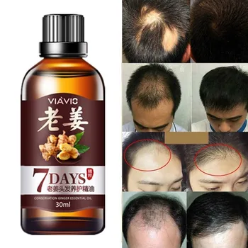 Hair Growth Liquid Ginger Essential Oil Dense Regrowth Serum Oil Anti Loss Treatment Repair Hair Growth Hair Care Drop Shipping
Hair Growth Liquid Ginger Essential Oil Dense Regrowth Serum Oil Anti Loss Treatment Repair Hair Growth Hair Care Drop Shipping