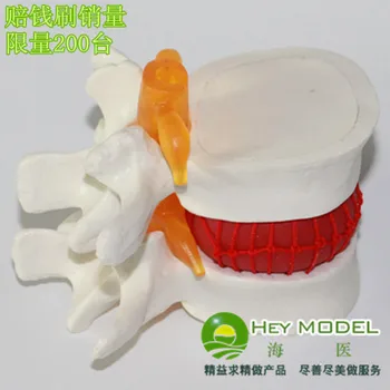 lumbar spine model human lumbar disc herniation model human skeleton model 
lumbar spine model human lumbar disc herniation model human skeleton model
