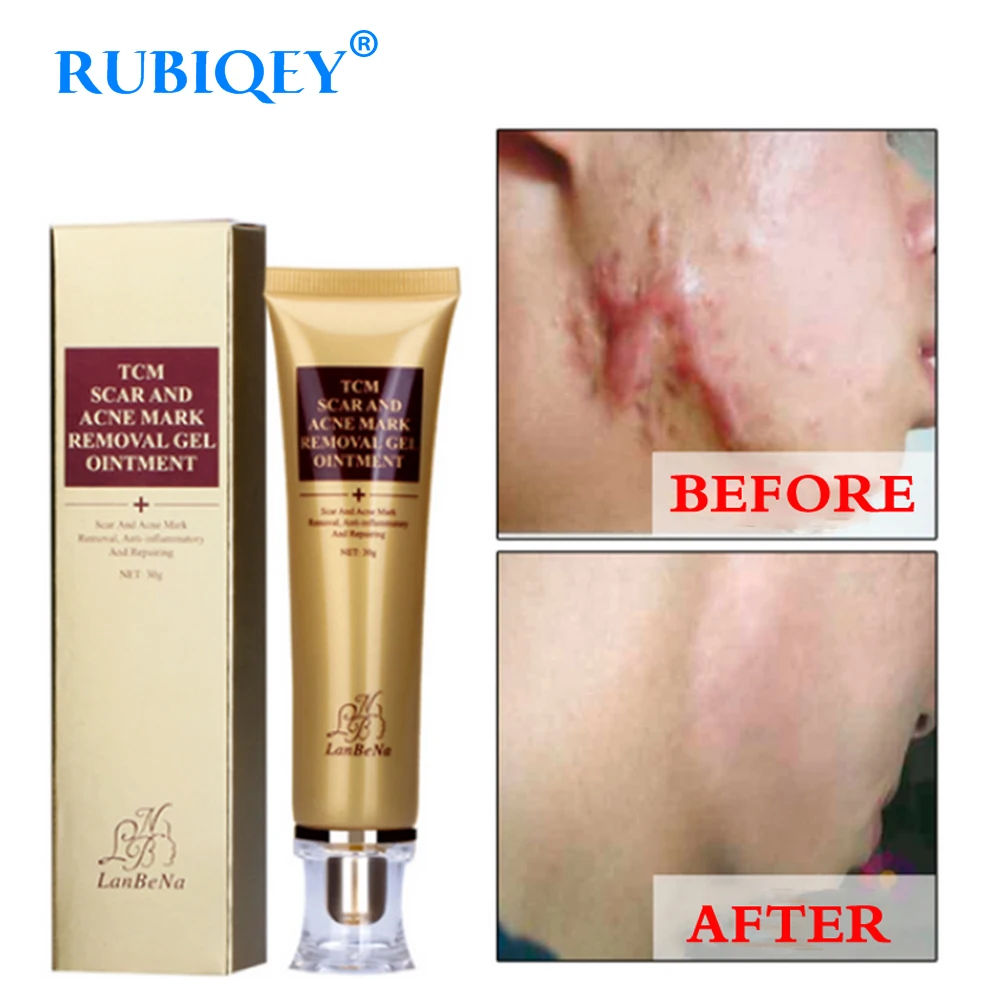 LANBENA Scar Removal Cream Ginseng Extract Skin Care Repair Spots Acne Treatment Stretch Marks facial blackhead Bleaching Cream
LANBENA Scar Removal Cream Ginseng Extract Skin Care Repair Spots Acne Treatment Stretch Marks facial blackhead Bleaching Cream