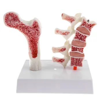 1: 1 Femur Skeletal Pathology Model Human Medical Anatomical Model for School Teaching Tool Learning Display Lab Supplies
1: 1 Femur Skeletal Pathology Model Human Medical Anatomical Model for School Teaching Tool Learning Display Lab Supplies