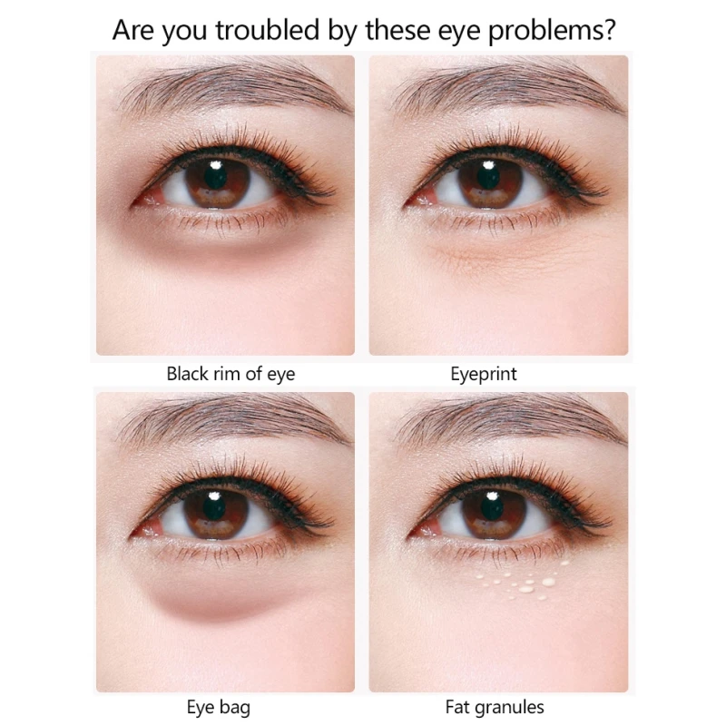 Gold Repair Gel Eye Mask Moisturizing Anti-puffiness Dark Circles Firming Skin Eye Patches
Gold Repair Gel Eye Mask Moisturizing Anti-puffiness Dark Circles Firming Skin Eye Patches