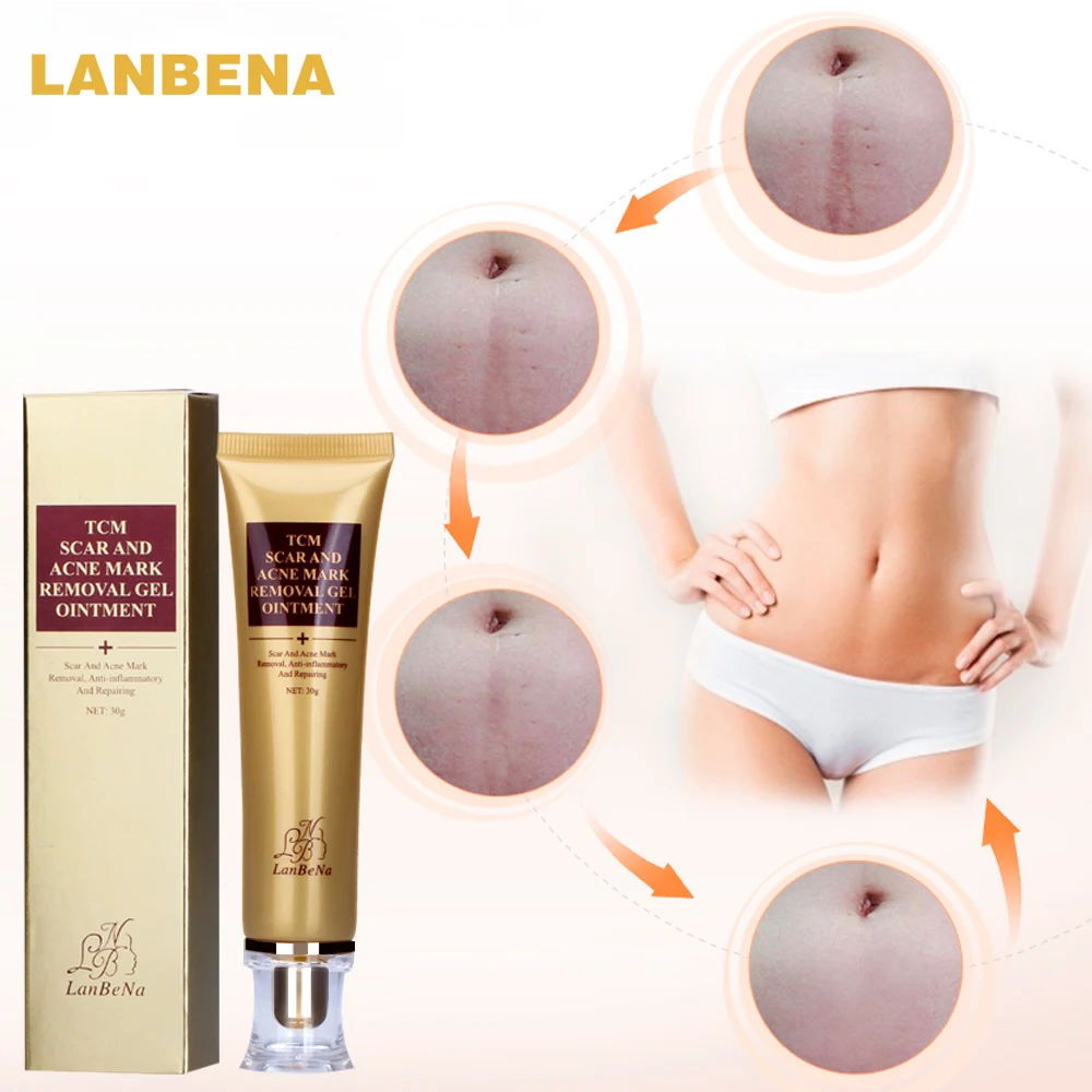 Acne Scar Removal Cream Skin Repair Face Cream Acne Spots Acne Treatment Blackhead Whitening Cream Stretch Marks 30ml
Acne Scar Removal Cream Skin Repair Face Cream Acne Spots Acne Treatment Blackhead Whitening Cream Stretch Marks 30ml