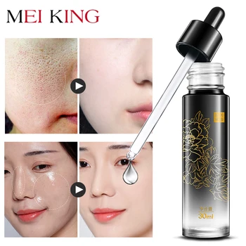 Acid Laminaria Ochreuloca Face Serum Liquid Anti-Wrinkle Anti Aging Facail Essence Moisturizing Whitening#
Acid Laminaria Ochreuloca Face Serum Liquid Anti-Wrinkle Anti Aging Facail Essence Moisturizing Whitening#