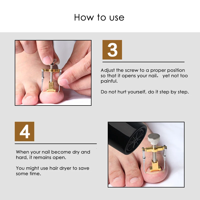 Nail-Corrector--07