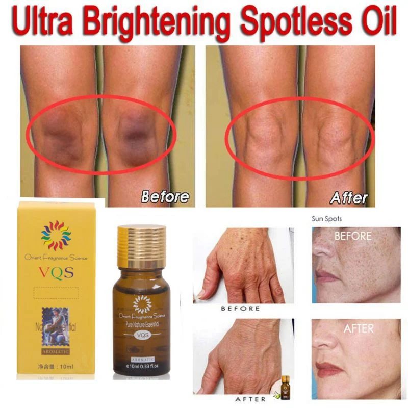 Whitening Essential Oil Brightening Spotless Oil Skin Care Dark Spots Remove Ance Burn Strentch Marks Scar Removal Essence
Whitening Essential Oil Brightening Spotless Oil Skin Care Dark Spots Remove Ance Burn Strentch Marks Scar Removal Essence