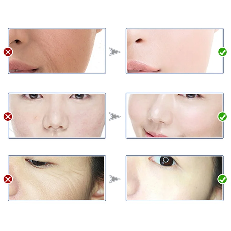 KK0180 (3)