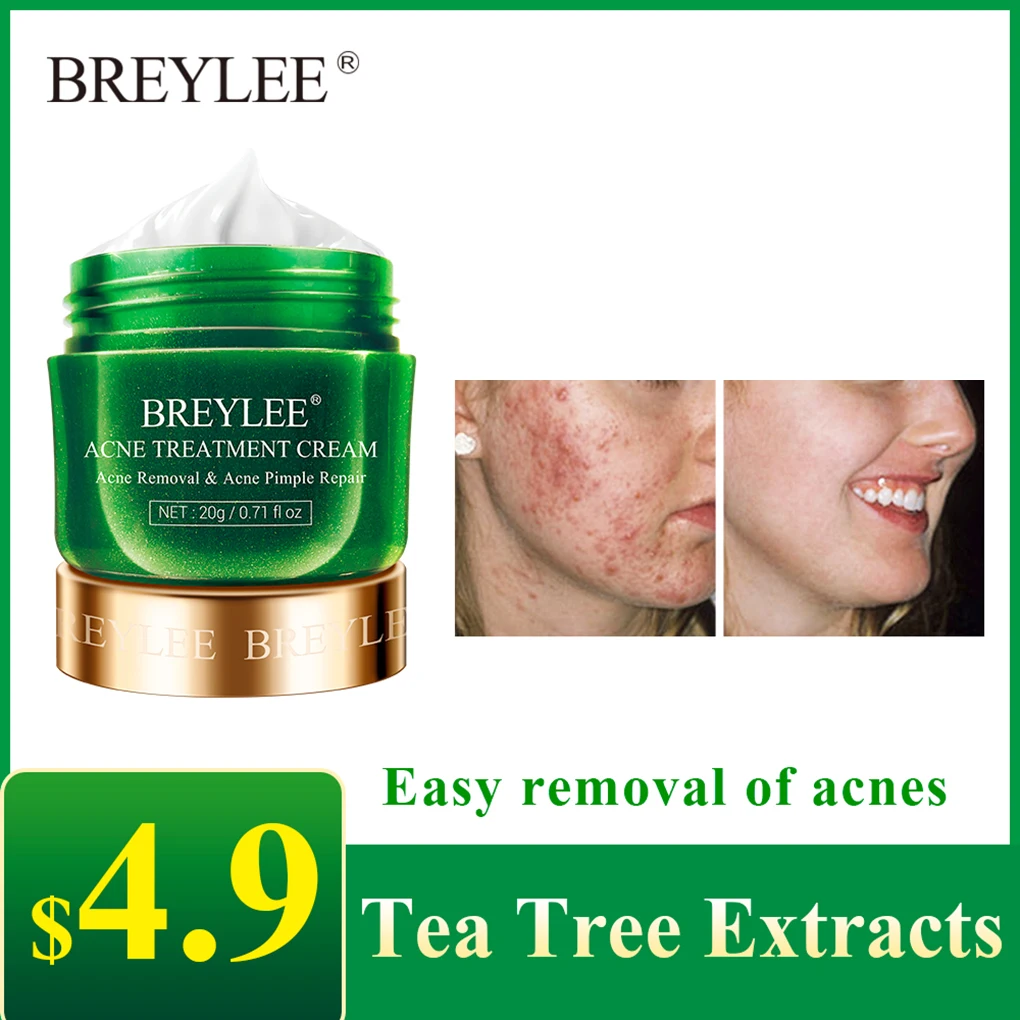 BREYLEE Acne Treatment Cream Anti Acne Face Cream Pimple Removal Spots Oil Control Moisturizing Skin Care Serum 20g
BREYLEE Acne Treatment Cream Anti Acne Face Cream Pimple Removal Spots Oil Control Moisturizing Skin Care Serum 20g