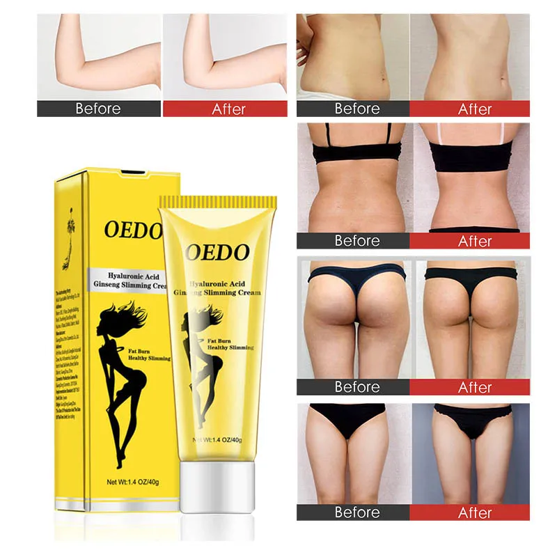 OEDO Hyaluronic Acid Ginseng Slimming Cream Reduce Cellulite Lose Weight Burning Fat Slimming Health Care Burning Creams TSLM1
OEDO Hyaluronic Acid Ginseng Slimming Cream Reduce Cellulite Lose Weight Burning Fat Slimming Health Care Burning Creams TSLM1