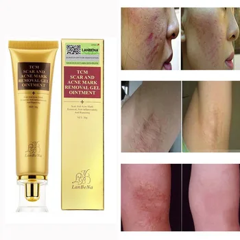 Acne Scar Removal Cream Skin Repair Face Cream Acne Spots Acne Treatment Blackhead Whitening Cream Stretch Marks
Acne Scar Removal Cream Skin Repair Face Cream Acne Spots Acne Treatment Blackhead Whitening Cream Stretch Marks